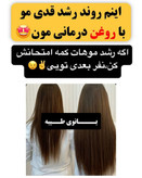 تونیک ضد ریزش و و رویش مجدد مو دوقلو برند اکسونیک(قسطی ۲ عدد)