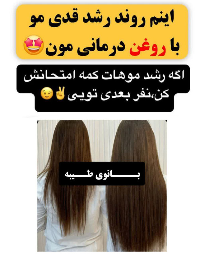 تونیک ضد ریزش و و رویش مجدد مو دوقلو برند اکسونیک(قسطی ۲ عدد)