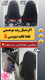 تونیک ضد ریزش و و رویش مجدد مو دوقلو برند اکسونیک(قسطی ۲ عدد)