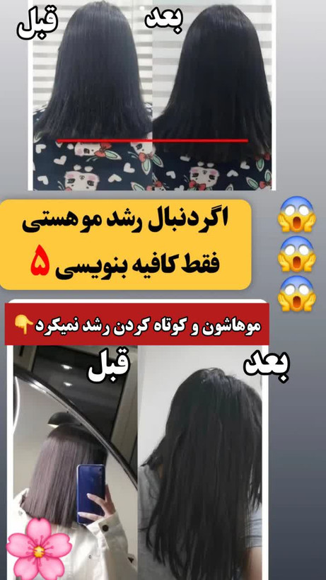 تونیک ضد ریزش و و رویش مجدد مو دوقلو برند اکسونیک(قسطی ۲ عدد)