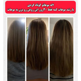 تونیک ضد ریزش و و رویش مجدد مو دوقلو برند اکسونیک(قسطی ۲ عدد)